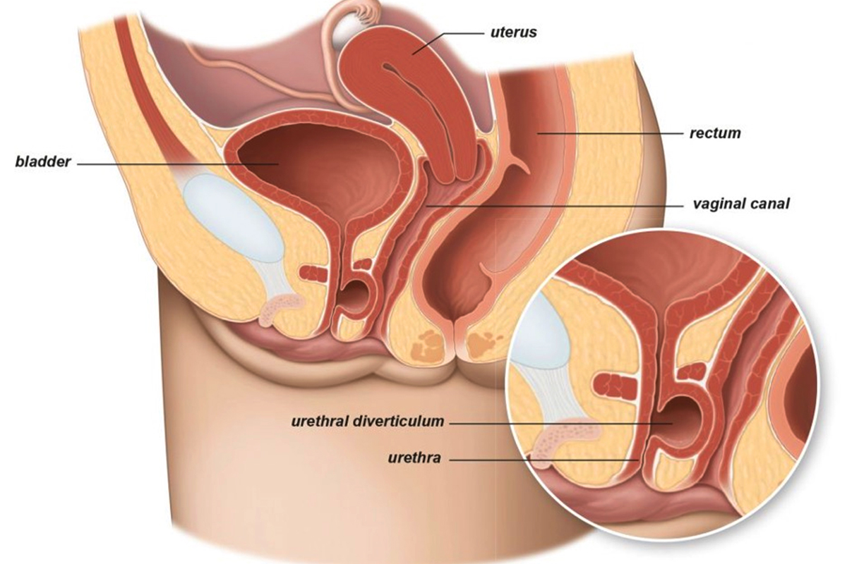 urologist-singapore-urohealth-medical-clinic