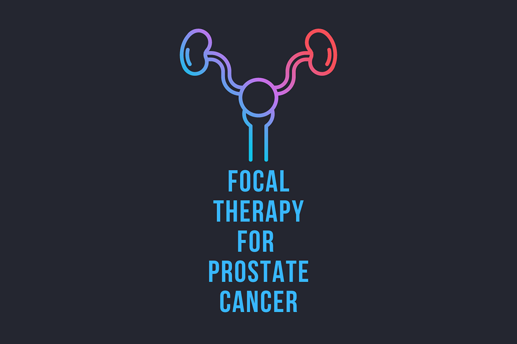 Read more about the article Focal therapy for prostate cancer