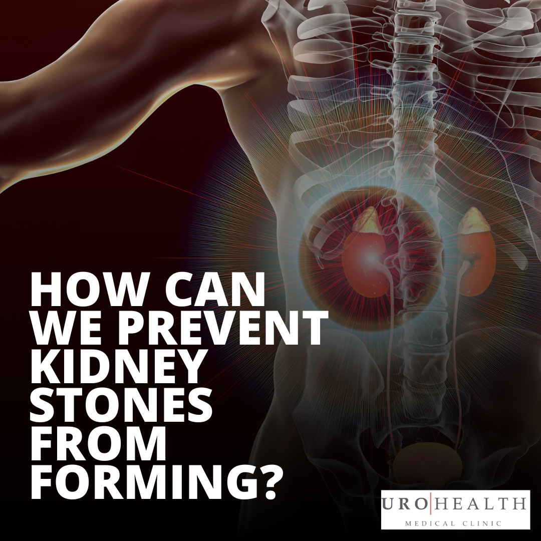 Read more about the article How can we prevent kidney stones before they form?