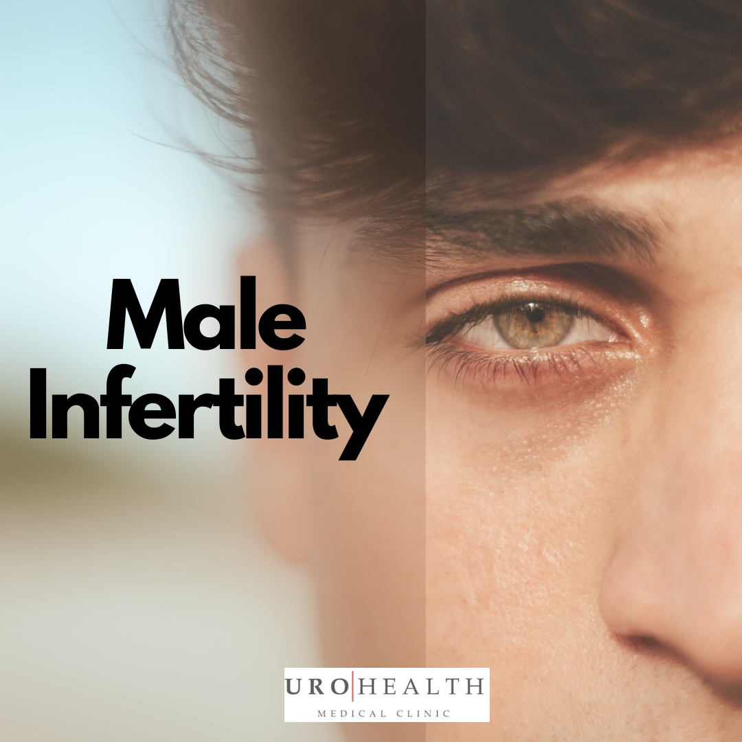 Read more about the article Let’s talk about male infertility