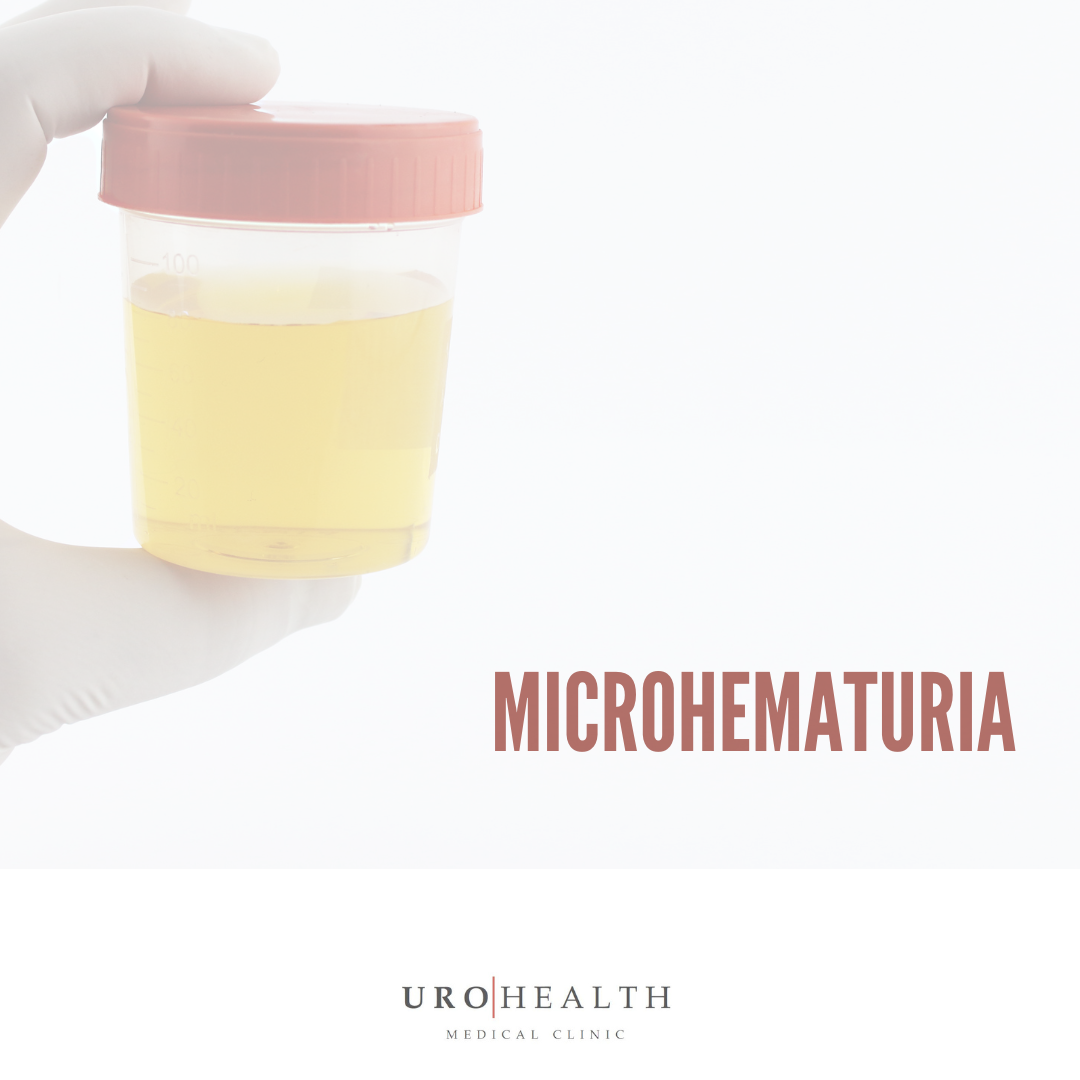 Read more about the article Microhematuria